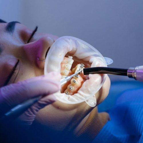 حالة قبل وبعد: ابتسامة السيدة نورة – ثقة تُولد من جديد