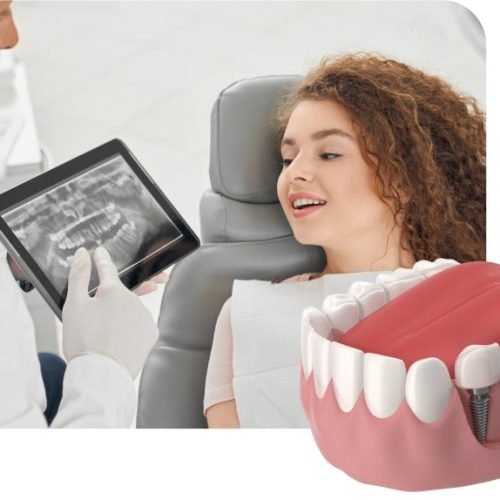 ابتسامة هوليوود – سر الجاذبية والثقة